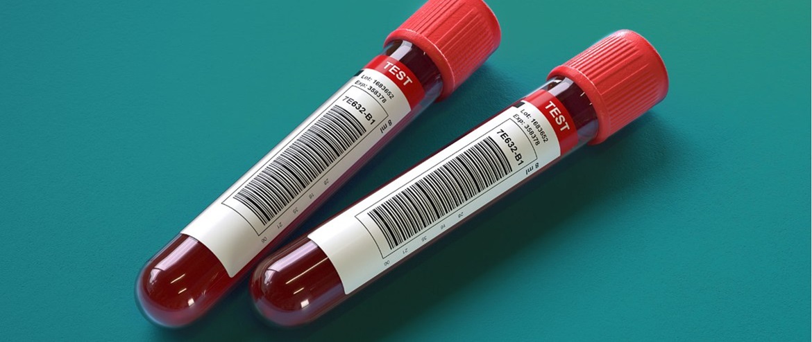 Consejos para mejorar los sistemas sanitarios con las tecnologías de impresión Brother
